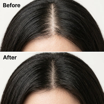 Avonique™ Scalp Revival Bar