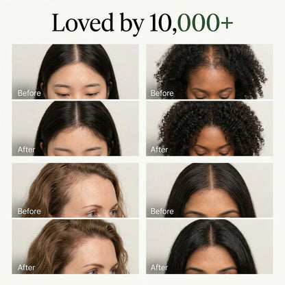 Avonique™ Scalp Revival Bar